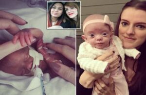 Μωρό θαύμα που γεννήθηκε 820 γραμμάρια και ήταν μικρότερο από ένα iPad επέζησε και είναι πλέον ένα υγιέστατο κοpιτσάκι Μωρό-θαύμα-που-γεννήθηκε-820-γραμμάρια-και-ήταν-μικρότερο-από-ένα-ipad-επέζησε-και-είναι-πλέον-ένα-υγιέστατο-κοpιτσάκι