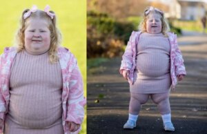 5χρονη που ζυγίζει 45 κιλά πάσχει από σύνδρομο που την κάνει διαρκώς να πεινάει 5χρονη-που-ζυγίζει-45-κιλά-πάσχει-από-σύνδρομο-που-την-κάνει-διαρκώς-να-πεινάει