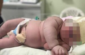 Βραζιλία: Γεννήθηκε μωρό βάρους 7,3 κιλών – «Δεν περίμενα τέτοια έκπληξη», λέει η μητέρα Βραζιλία:-Γεννήθηκε-μωρό-βάρους-7,3-κιλών-–-«Δεν-περίμενα-τέτοια-έκπληξη»,-λέει-η-μητέρα