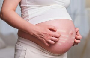 Δερματοπάθειες στην εγκυμοσύνη: Πού οφείλονται και ποιες είναι οι πιο συχνές Δερματοπάθειες-στην-εγκυμοσύνη:-Πού-οφείλονται-και-ποιες-είναι-οι-πιο-συχνές