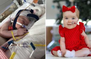 Μπεμπούλα που γεννήθηκε με ζωτικά όργανα έξω από το σώμα της, επιβίωσε και είναι καλά! Μπεμπούλα-που-γεννήθηκε-με-ζωτικά-όργανα-έξω-από-το-σώμα-της,-επιβίωσε-και-είναι-καλά!