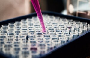 Όλα όσα πρέπει να γνωρίζουμε για τον στρεπτόκοκκο που στέρησε την ζωή σε 15 παιδιά στην Μ.Βρετανία Όλα-όσα-πρέπει-να-γνωρίζουμε-για-τον-στρεπτόκοκκο-που-στέρησε-την-ζωή-σε-15-παιδιά-στην-Μ.Βρετανία