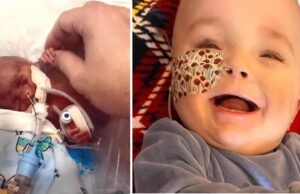 Μωράκι που του έδιναν 1 μέρα ζωής, έσβησε το 1ο του κεράκι Μωράκι-που-του-έδιναν-1-μέρα-ζωής,-έσβησε-το-1ο-του-κεράκι