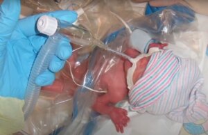 Αυτό το μωράκι γεννήθηκε 3.5 μήνες νωρίτερα και τα κατάφερε! Αυτό-το-μωράκι-γεννήθηκε-3.5-μήνες-νωρίτερα-και-τα-κατάφερε!