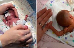 Πρόωρο κοριτσάκι που γεννήθηκε στις 23 εβδομάδες κέρδισε τη μάχη της ζωής του! Πρόωρο-κοριτσάκι-που-γεννήθηκε-στις-23-εβδομάδες-κέρδισε-τη-μάχη-της-ζωής-του!