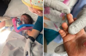 Νηπιάκι έπαθε σοβαρό έγκαυμα στο χέρι – ακούμπησε το μάτι της κουζίνας Νηπιάκι-έπαθε-σοβαρό-έγκαυμα-στο-χέρι-–-ακούμπησε-το-μάτι-της-κουζίνας