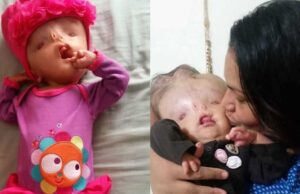 «Δεν είναι εξωγήινος το παιδί μου, είναι μία πραγματική μαχήτρια»: Μία συγκλονιστική ιστορία «Δεν-είναι-εξωγήινος-το-παιδί-μου,-είναι-μία-πραγματική-μαχήτρια»:-Μία-συγκλονιστική-ιστορία