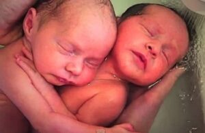 Δίδυμα δεν κατάλαβαν ότι γεννήθηκαν και μένουν αγκαλιασμένα όπως ήταν στην κοιλιά της μαμάς τους Δίδυμα-δεν-κατάλαβαν-ότι-γεννήθηκαν-και-μένουν-αγκαλιασμένα-όπως-ήταν-στην-κοιλιά-της-μαμάς-τους