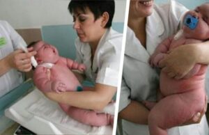 Μωρό γεννήθηκε 18 κιλά και είναι το μεγαλύτερο σε όλο το κόσμο Μωρό-γεννήθηκε-18-κιλά-και-είναι-το-μεγαλύτερο-σε-όλο-το-κόσμο