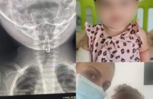 Λεμεσός: Βρέφος οκτώ μηνών κατάπιε παραμάνα Λεμεσός:-Βρέφος-οκτώ-μηνών-κατάπιε-παραμάνα