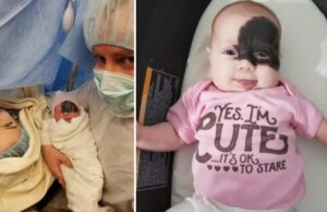 «Η κόρη μας γεννήθηκε με σπάνιο εκ γενετής σημάδι κι μοιάζει με υπερήρωα!» «Η-κόρη-μας-γεννήθηκε-με-σπάνιο-εκ-γενετής-σημάδι-κι-μοιάζει-με-υπερήρωα!»