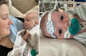 Πρωτοποριακή επέμβαση καρδιάς έσωσε τη ζωή νεογέννητου μωρού Πρωτοποριακή-επέμβαση-καρδιάς-έσωσε-τη-ζωή-νεογέννητου-μωρού