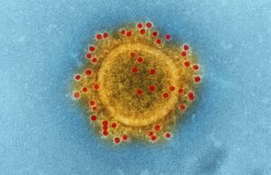 Γρίπη της ντομάτας: Ο μεταδοτικός ιός που απειλεί τα παιδιά – Τα συμπτώματα Γρίπη-της-ντομάτας:-Ο-μεταδοτικός-ιός-που-απειλεί-τα-παιδιά-–-Τα-συμπτώματα