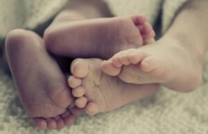 Δίδυμα γεννήθηκαν με εντελώς διαφορετικό χρώμα δέρματος Δίδυμα-γεννήθηκαν-με-εντελώς-διαφορετικό-χρώμα-δέρματος