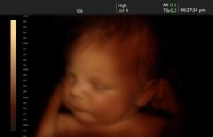 Οι επιστήμονες μίλησαν: 4 παράγοντες που επηρεάζουν την ευφυΐα του εμβρύου Οι-επιστήμονες-μίλησαν:-4-παράγοντες-που-επηρεάζουν-την-ευφυΐα-του-εμβρύου