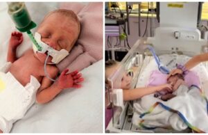 Γεννήθηκε μόλις στις 25 εβδομάδες κύησης στην Κύπρο: «Παλεύω να δεθώ μαζί της» Γεννήθηκε-μόλις-στις-25-εβδομάδες-κύησης-στην-Κύπρο:-«Παλεύω-να-δεθώ-μαζί-της»