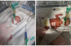 Κύπρος: Αγώνας για επαναπατρισμό πρόωρου βρέφους: «Ένιωσα τόσο μόνη» Κύπρος:-Αγώνας-για-επαναπατρισμό-πρόωρου-βρέφους:-«Ένιωσα-τόσο-μόνη»