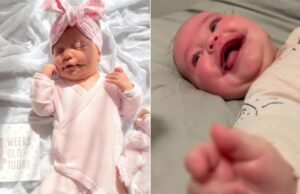 Μωράκι γεννήθηκε με «μόνιμο χαμόγελο» λόγω σπάνιας πάθησης! Μωράκι-γεννήθηκε-με-«μόνιμο-χαμόγελο»-λόγω-σπάνιας-πάθησης!