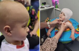 Μωράκι με πλαγιοκεφαλία θα λάβει επιτέλους τη θεραπεία που θα του αλλάξει τη ζωή! Μωράκι-με-πλαγιοκεφαλία-θα-λάβει-επιτέλους-τη-θεραπεία-που-θα-του-αλλάξει-τη-ζωή!