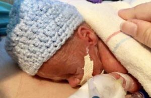 Η απίστευτη ιστορία του προώρου μωρού που οι γονείς του πάλευαν με την υπογονιμότητα Η-απίστευτη-ιστορία-του-προώρου-μωρού-που-οι-γονείς-του-πάλευαν-με-την-υπογονιμότητα