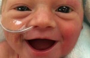 «Είναι χαρούμενη που ζει!»: Το πιο όμορφο χαμόγελο από ένα πρόωρο μωρό «Είναι-χαρούμενη-που-ζει!»:-Το-πιο-όμορφο-χαμόγελο-από-ένα-πρόωρο-μωρό