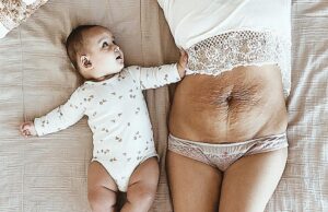 Το σώμα μου μετά τον τοκετό δεν ήταν «ελαττωματικό», αλλά πανέμορφο! Το-σώμα-μου-μετά-τον-τοκετό-δεν-ήταν-«ελαττωματικό»,-αλλά-πανέμορφο!