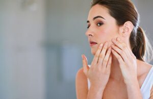 Όσα πρέπει να ξέρετε για την ακμή στην εγκυμοσύνη Όσα-πρέπει-να-ξέρετε-για-την-ακμή-στην-εγκυμοσύνη