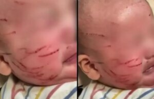 Πήρε το μωρό της από τον παιδικό σταθμό και ήταν γεμάτο γρατσουνιές στο πρόσωπο: Η απάντηση που της έδωσαν Πήρε-το-μωρό-της-από-τον-παιδικό-σταθμό-και-ήταν-γεμάτο-γρατσουνιές-στο-πρόσωπο:-Η-απάντηση-που-της-έδωσαν