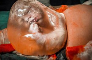 Το θαύμα της ζωής μέσα από 16 βραβευμένες φωτογραφίες Το-θαύμα-της-ζωής-μέσα-από-16-βραβευμένες-φωτογραφίες