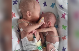 Πρώορο κοριτσάκι επιβίωσε για να αγκαλιάσει τον αδερφό της