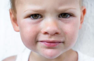 Άφθες στα παιδιά: Πού οφείλονται και πώς αντιμετωπίζονται