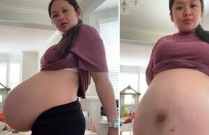 «Πήρα 27 κιλά στην εγκυμοσύνη και όλοι νομίζουν ότι είμαι έγκυος σε 4δυμα»