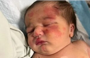 Πώς ένας σκύλος έσωσε αυτό το αγγελούδι που το κακοποίησαν και το πέταξαν στα σκουπίδια