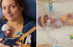 Προωράκι 330 γραμμαρίων έδωσε μάχη για να κρατηθεί στη ζωή και τα κατάφερε!