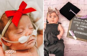 Προωράκι παίρνει εξιτήριο μετά από 158 μέρες στο νοσοκομείο και θα κάνει γιορτές σπίτι του!