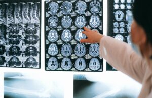 Βέλγιο: Για πρώτη φορά παιδί «νίκησε» θανατηφόρο καρκίνο του εγκεφάλου