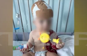 Σκύλος δάγκωσε στο κεφάλι 11 μηνών αγοράκι την ώρα που το τάιζαν οι γονείς του