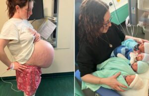 Απέκτησαν 4δυμα με φυσικό τρόπο – συμβαίνει 1 στις 700.000!