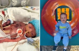 Προωράκι που γεννήθηκε στις 27 εβδομάδες έγινε 2 ετών: «κανείς δεν πίστευε ότι θα τα καταφέρει»