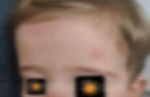 Κατηγορείται για αμέλεια η ιδιοκτήρια νηπιαγωγείου στη Λεμεσό