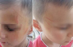 Αγρίνιο: μαθητές νηπιαγωγείου ξυλοκόπησαν άγρια 5χρονο συμμαθητή τους!