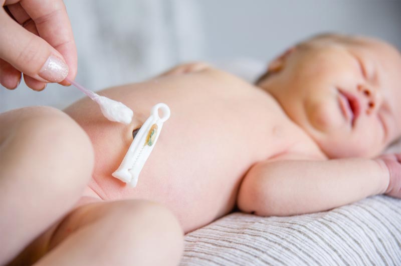 Η ACOG αναθεωρεί την πρακτική απολίνωσης του ομφάλιου λώρου στα πρόωρα μωρά