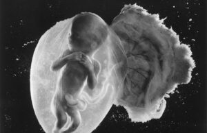 Αυτή είναι η κορυφαία φωτογραφία του περασμένου αιώνα και απεικονίζει ένα έμβρυο 18 εβδομάδων