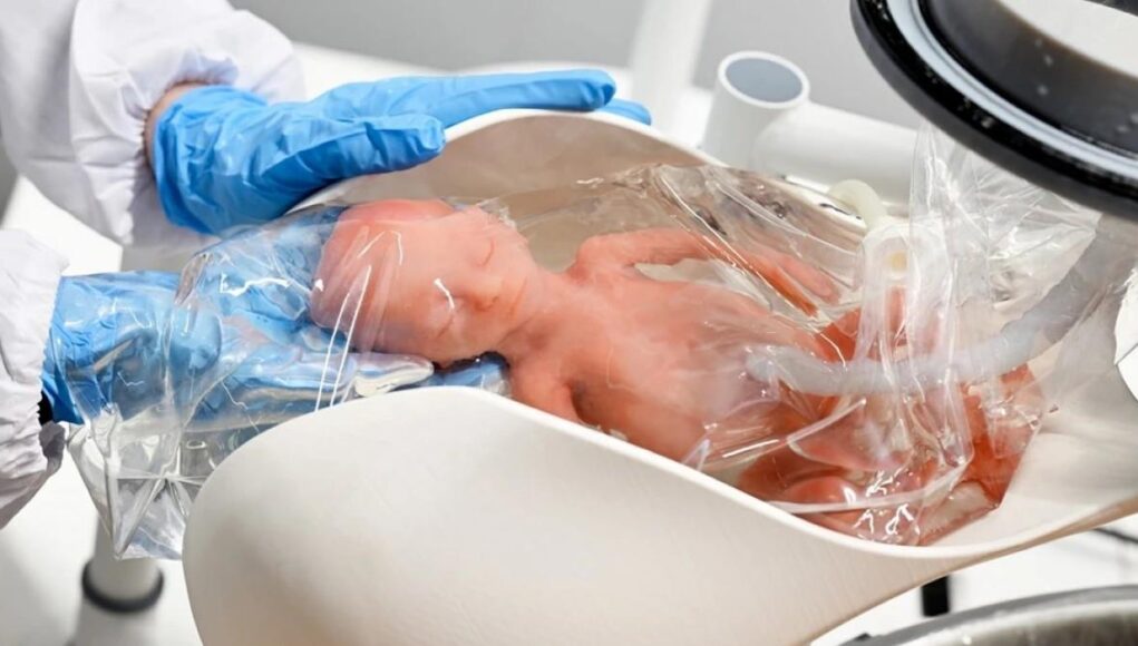 Εταιρεία τελειοποιεί τεχνητή μήτρα που μπορεί να κρατήσει ζωντανό ένα μωρό!