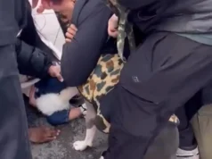 Τρόμος για παιδί 1 έτους στη Νέα Υόρκη: Του επιτέθηκε πίτμπουλ και δεν το άφηνε από τα σαγόνια του