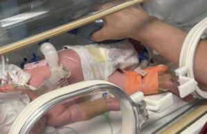 Ιατρικό επίτευγμα στη Λάρισα: έσωσαν την όραση σε προωράκι 600 γραμμαρίων