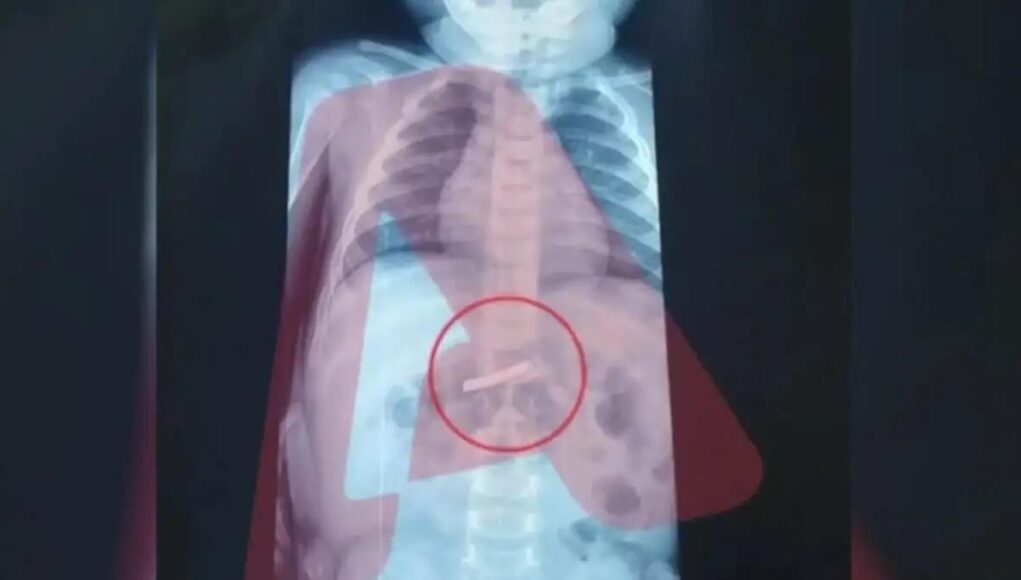 &Alpha;&gamma;&omega;&nu;&iota;ά &gamma;&iota;&alpha; 3&chi;&rho;&omicron;&nu;&omicron; &pi;&omicron;&upsilon; &kappa;&alpha;&tau;ά&pi;&iota;&epsilon; &xi;&upsilon;&rho;&alpha;&phi;ά&kappa;&iota; &ndash; &nu;&omicron;&sigma;&eta;&lambda;&epsilon;ύ&epsilon;&tau;&alpha;&iota; &sigma;&tau;&omicron; &Pi;&alpha;ί&delta;&omega;&nu;